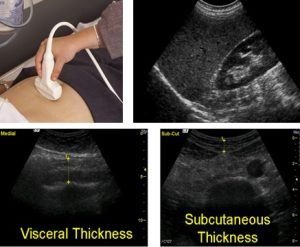 ultrasound scan mrc pregnancy visualize exactly routinely same during baby used