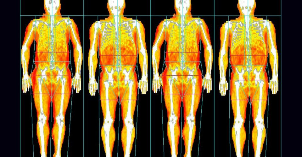 DEXA_NewsArticleImage_3000px